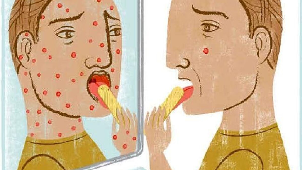 Triệu chứng rối loạn lo âu bệnh tật